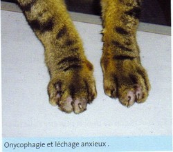 onychophagie